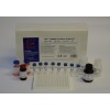 Human Fetuin-A ELISA Kit