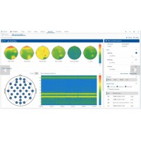 EEG腦電分析軟件